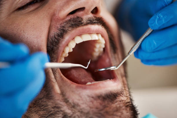 Best Emergency Dental Care for Abscessed Tooth in Heavener, OK