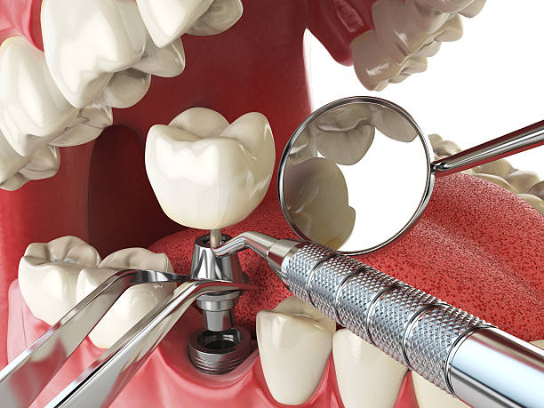 Best Emergency Dentist for Knocked-Out Tooth in Heavener, OK