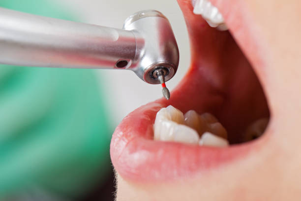 Best Emergency Dentist for Lost Fillings or Crowns in Heavener, OK
